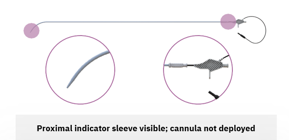 Proximal Sleeve1